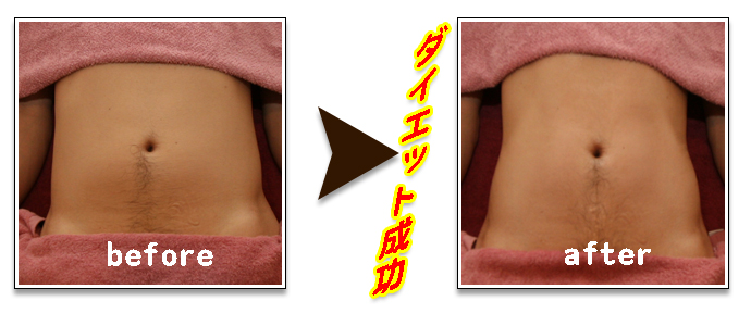 脂肪燃焼コース　before after